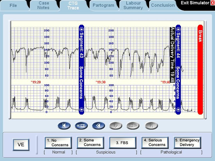 Simulator Case - Incompete Interpretation - Actual Delivery time section